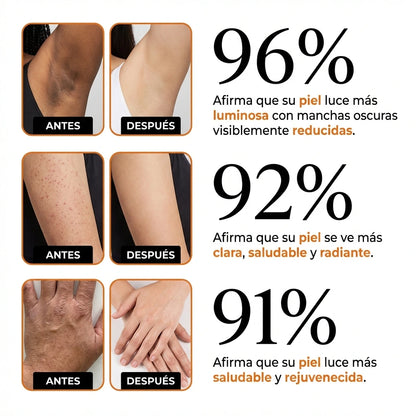 Spray Exfoliante Corporal - Ácido Kójico + Cúrcuma